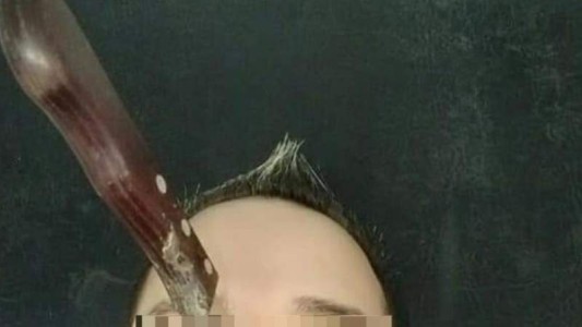 "Ingresó al hospital con el cuchillo clavado en la cara": operaron al colectivero asaltado