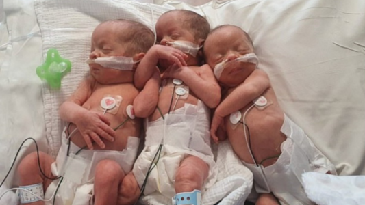 Los "trillizos de Gales" que tuvieron un parto histórico