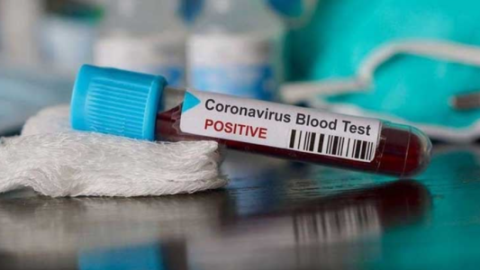 Oficial: no se confimaron casos ni hubo muertes por Covid-19 este domingo en Córdoba