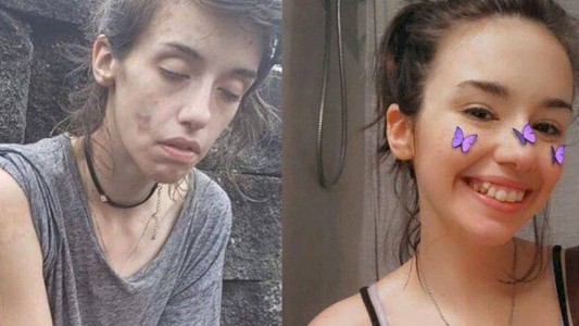 Una chica subió su foto "antes y después" para mostrar cómo se recuperó de su adicción a las drogas