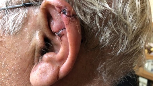 Por miedo al coronavirus y para no ir al hospital, se hizo coser la oreja por un veterinario