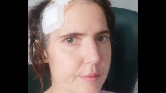 Empezó con un dolor en la muela de juicio y casi muere por una infección cerebral