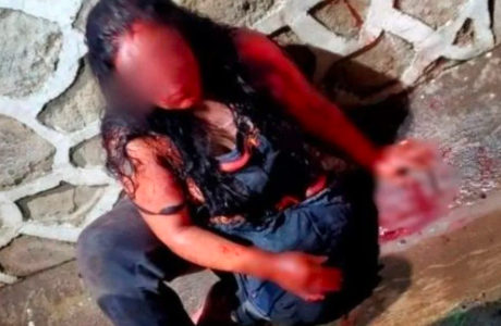 Decapitó a su marido e intentó huir con la cabeza