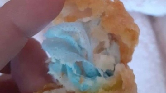 Una nena de 6 años casi se asfixia por comer una patita de pollo que tenía un barbijo  adentro