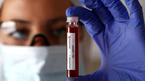 Coronavirus: un análisis en la sangre podria indicar que personas pueden tener un cuadro grave
