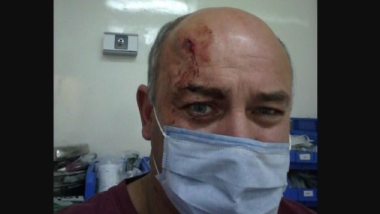 Ladrones balearon a un hombre en la cabeza y se salvó de milagro