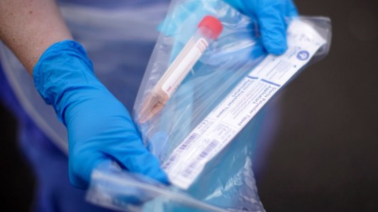 Santa Fe: reportan 1055 nuevos casos de Covid-19