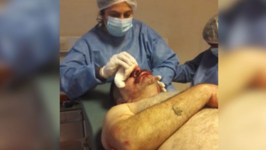 Chaco: feroz ataque a un periodista mientras hacía su programa de radio