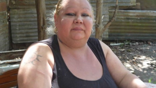 Mala praxis: Le inyectaron aceite de avión y pide ser operada urgente para calmar los dolores