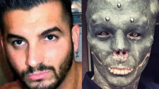 La increíble transformación del "hombre alien"