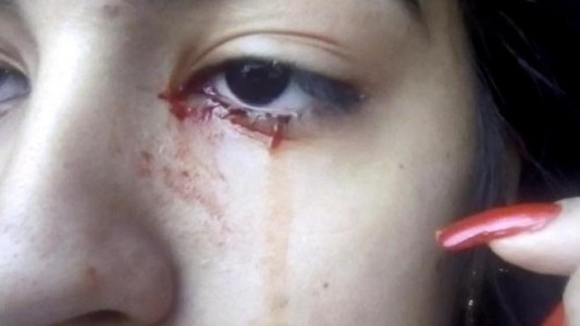 Misterio por la chica de 15 años que llora lágrimas de sangre