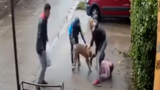 Habló la familia de la nena atacada por un pitbull: "Tiene la pierna destrozada"