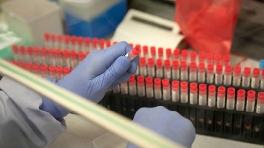 Coronavirus: estudios indican qué tipo de sangre es más susceptible de desarrollar cuadros graves