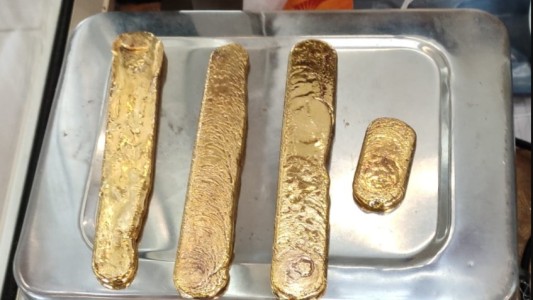 Detenido en el aeropuerto con un kilo de oro escondido en el recto