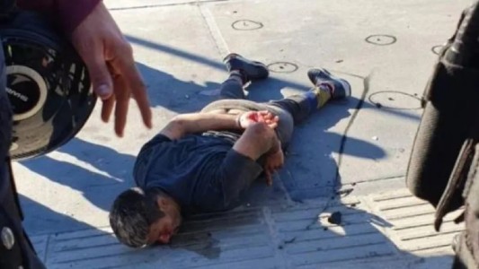 El "tirador de Retiro" recibió tres disparos, está grave y analizan amputarle una pierna