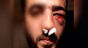 Habló el padre del verdulero golpeado brutalmente por manifestantes del SUOEM