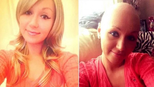 Murió de cáncer a los 23 años después de que le negaron 15 veces un examen