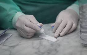 Estados Unidos homologa un test que mide los anticuerpos contra el coronavirus