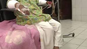 Una mujer quemó las manos de su hija de 6 años por robar golosinas