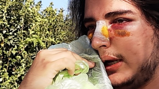 Ampliaron la imputación de los agresores de Lautaro Insúa