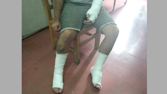 Capataz tiró a un albañil desde un segundo piso por hacer mal una losa