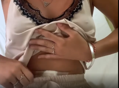 VIDEO: dramático testimonio de la chica que terminó en el quirófano por el uso de la copa menstrual