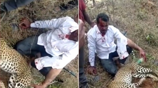 "Logré matarlo con la rodilla": enfrentó a un leopardo que atacó a su familia