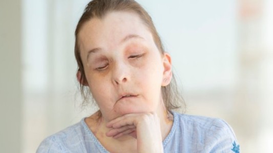 Mostró su rostro la mujer que recibió dos trasplantes de cara