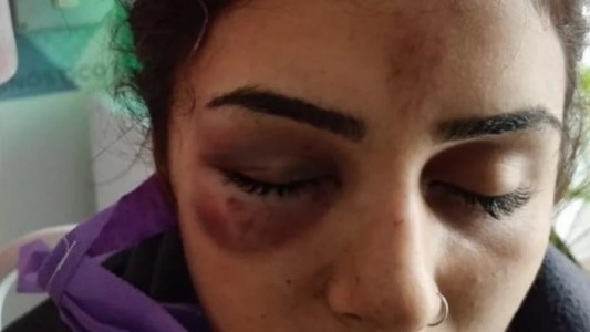 La sorprendieron de atrás tres chicas y la molieron a golpes: tiene fractura de cráneo