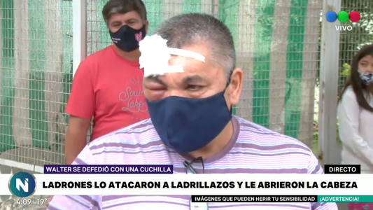 Dramático testimonio: recibió 14 puntos de sutura y una grave herida en su ojo producto de un asalto