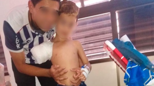Un secarropas le amputó el brazo a un niño de 6 años
