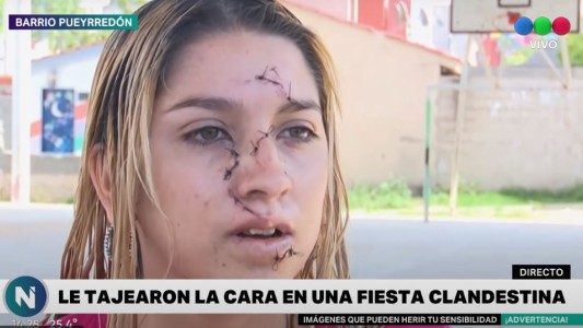 Una joven de 19 años fue detenida por cortarle la cara a otra chica con una botella rota