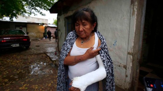 "Si gritás, te quemamos": le entraron a robar a su casa y le quebraron el brazo