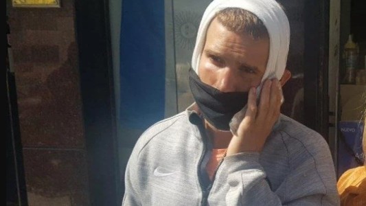 Denunció que le dieron una paliza en un boliche: "Eran seis patovicas contra mi"