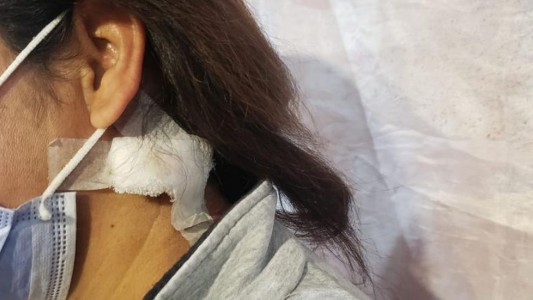 Estremecedor relato de la mujer de Tanti baleada en el cuello por su pareja: "Yo hoy estoy viva para contarlo"