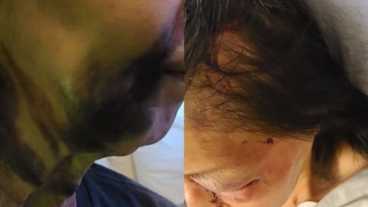 Jubilada fue brutalmente golpeada por una mujer porque "parecía asíatica"