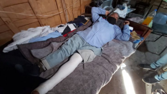 Ladrones enojados por magro botín, le quebraron varios huesos a la víctima