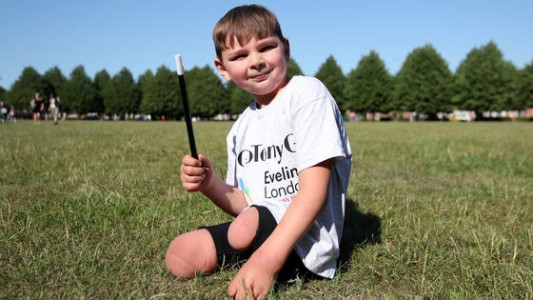 Un nene le amputaron las piernas por los abusos de sus padres y ahora logró caminar con prótesis