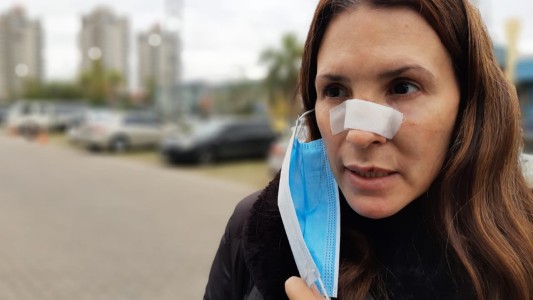 Golpiza en los Boulevares: abogado de la víctima pide investigar a los policías