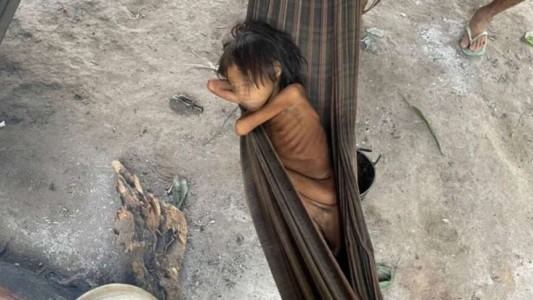 La desgarradora foto de una nena de 8 años que pesa 12 kilos que conmovió a Brasil