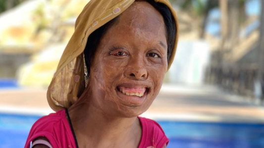 Su padre la quemó, la golpeó y la vendió: la niña dice que la Virgen de Guadalupe la salvó