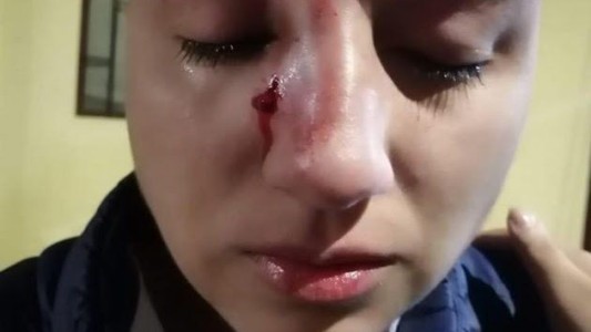 Brutal paliza de un taxista a una mujer por ser lesbiana: "El machito no va a pagar"