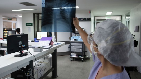 Coronavirus en Argentina: reportan 465 muertos y 20.363 casos en las últimas 24 horas