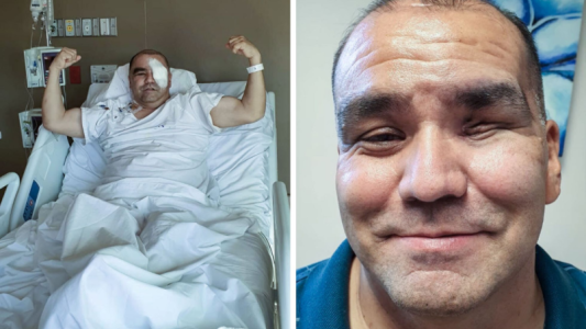 Sobreviviente del terrorífico hongo negro: “Me despertaba en la madrugada llorando del dolor”