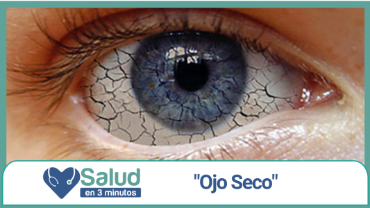Salud en 3 Minutos: Síndrome del Ojo Seco