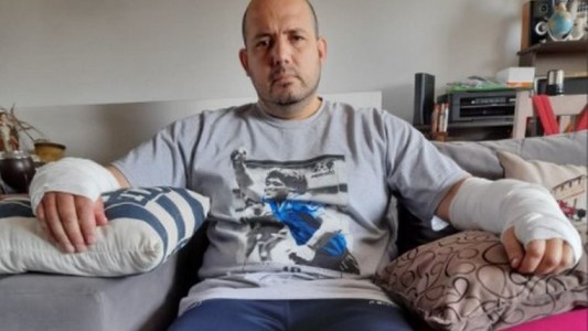 Feroz ataque de un pitbull en barrio Yapeyú