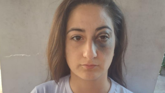 Un policía golpeó a una mujer tras un control policial