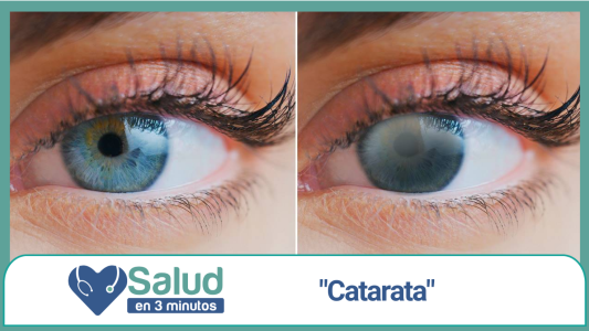 Las cataratas en los ojos ¿Son una enfermedad?