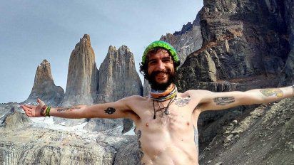 El hombre que vive sin colon, sin recto y sin estómago: "Estoy vacío por dentro y quiero llenarme de aventuras"