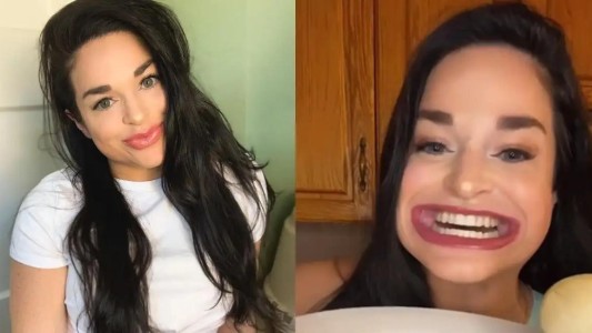 Récord Guinness: una mujer tiene la boca más grande del mundo